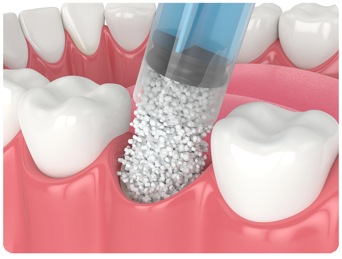 Options for International Patients